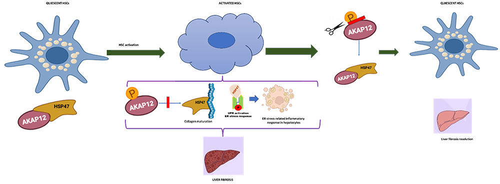 Role of A-Kinase anchoring proteins in liver fibrosis.
